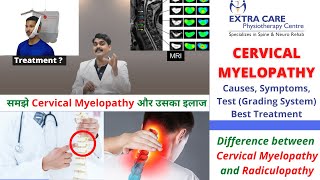 Cervical Myelopathy Physiotherapy Treatment  Causes Symptoms Test amp Grading  NO SURGERY NEEDED [upl. by Sigrid]