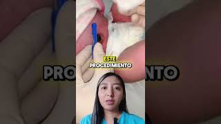 ⚠¡NO MAS COMPLICACIONES NEONATALES 👶 [upl. by Burget]