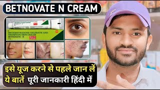 Betnovate n cream uses benefits and side effects full review in hindi [upl. by Ardeha]