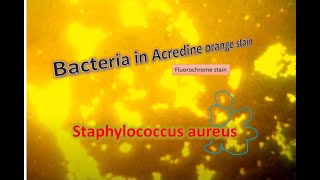 Staphylococcus aureus under Fluorescence microscopy [upl. by Asp]