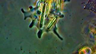 Amoeba with ingested Diatoms [upl. by Esahc]