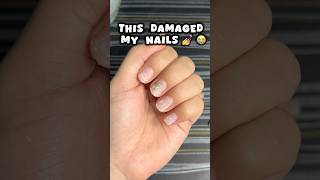 Nail extensions ki galti 😭😭nails nailsextension viralvideo shortsfeed viralshort trending [upl. by Arreyt774]