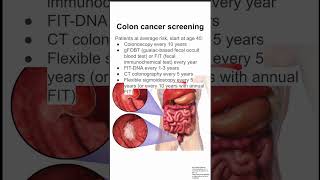 Colon cancer screening [upl. by Alaekim787]