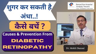 Diabetic Retinopathy Treatment amp Prevention  डायबिटीज से होने वाली आँखों की बीमारी  Diabetic Eye [upl. by Maziar]