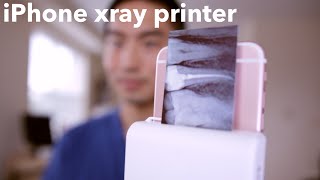 iPHONE XRAY PRINTER for DENTISTS [upl. by Buzzell]