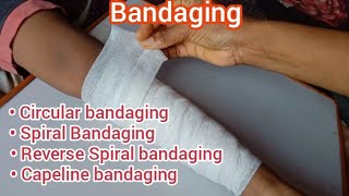 Bandaging and its Types  Capeline bandaging Circular bandaging Spiral bandaging Reverse Spiral [upl. by Chrysler361]