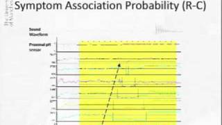 Acoustic Cough Reflux Associations in Chronic Cough [upl. by Anawik]