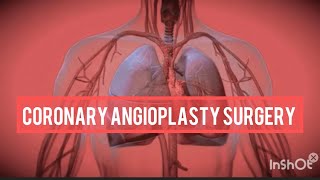 Angioplasty Procedure Animation Video  coronary angioplasty surgery  angioplasty surgery [upl. by Einwat]