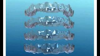 Invisalign digital animation [upl. by Daphne]