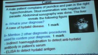 DrAzza  Parasitology  Helminths  Hymenolepis Infections  Part 1 [upl. by Powe39]