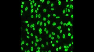 IIFANA STAINING PATTERNS INTERPRETATION  ANTINUCLEAR ANTIBODIES TESTING OF AUTOIMMUNE DISORDERS [upl. by Nance]