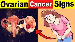 9 Common Ovarian Cancer Signs That You Should Never Ignore [upl. by An]