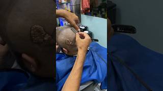 HeadShave before head tumor surgery dandruffheadshave healthyhairjourneycancer 😢part2 [upl. by Garry700]