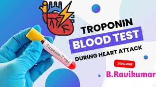 What is a Troponin test in Telugu  How is the tropt test done  Why do you do it  BRavikumar [upl. by Plath267]