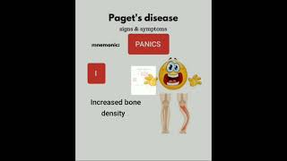 🐬 PAGETS disease MNEMONIC 🦈 [upl. by Rutra]