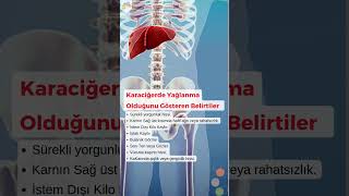 Karaciğerde Yağlanma Olduğunu Gösteren Belirtiler karaciğersağlığı karaciğeryağlanması [upl. by Canica]