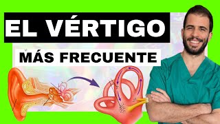 ➡️ Causas del VÉRTIGO POSICIONAL PAROXÍSTICO BENIGNO VPPB  Canales semicirculares y otolitos [upl. by Kristofor]