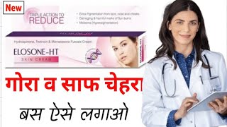 Elosone ht Skin Cream Kaise Use kare  Elosone ht skin cream side effects [upl. by Avlis]