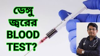 ডেঙ্গু জ্বরের টেস্ট চিকিৎসা ও সতর্কতা  Dengue fever blood test treatement amp awarenessVlog37 [upl. by Cadman651]