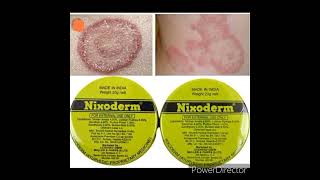 Nixoderm cream for skin problem Made in India Nixoderm cream [upl. by Nallac690]