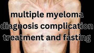 Understanding Multiple Myeloma Diagnosis Treatment and Fasting [upl. by Bamford503]