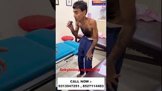 Chiropractic treatment in Madhya padres  Ankylosing spondylitis  Dr Varun madhyapradesh india [upl. by Pepito]