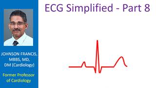 ECG Simplified  Part 8 [upl. by Ttirrej]