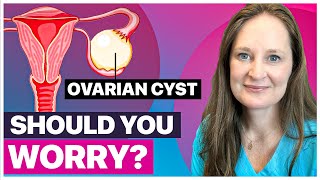 Ovarian Cysts Everything You Need to Know by Dr Lora Shahine [upl. by Julianna]