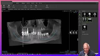 Dental Treatment Planning in a Medically Compromised Case [upl. by Lebam]