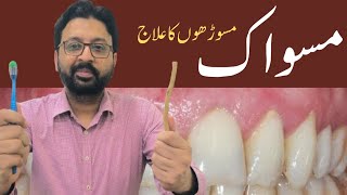 How to Use MISWAK to Heal Gum Recession [upl. by Joh643]