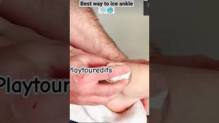 How to get rid of ankle swelling  How to apply icing around ankle joint 🧊 [upl. by Peddada]