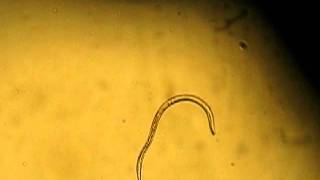 Strongyloides stercoralis filariform larvae [upl. by Heidy]