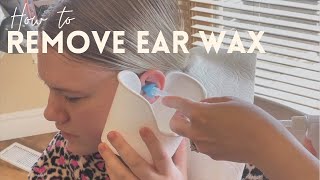 Amazing Ear Wax Removal [upl. by Ingham]