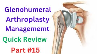 Glenohumeral Arthroplasty physiotherapy  Moderate protection phase Exercises [upl. by Laehcar]