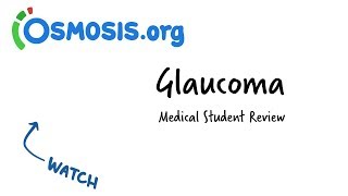 Glaucoma  Clinical Presentation [upl. by Michi]