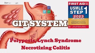 Polyposis Syndrome Lynch Syndrome Necrotizing Colitis first aid step 1USMLEUrduHindi [upl. by Rufena]