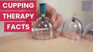 Cupping Therapy Health Facts You Must Know [upl. by Ymmat]