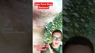 EPIC PORE STRIP REMOVAL  Fruit RollUp Blackhead Removal 😂 shorts [upl. by Niawat]