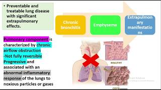 COPD General medicine Types Etiopathogenesis  Clinical features Chronic bronchitisEmphysema [upl. by Ecirtaemed519]