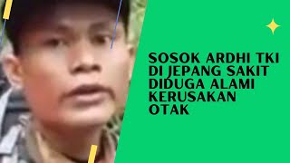 9 Kebiasaan yang Jadi Penyebab Kerusakan Otak Harus Diwaspadai kebiasaan penyebab kerusakanotak [upl. by Aifoz36]