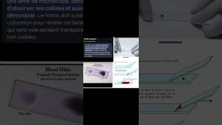 Frottis sanguin  Examen diagnostique [upl. by Lainad]