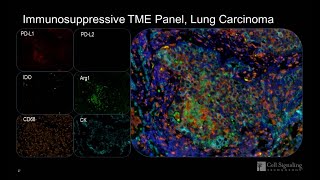 Myeloid Immunosuppression in the Tumor Microenvironment Characterized by SingleMultiplex IHC [upl. by Euqinomahs656]