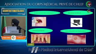 Dr MECID SOUHILA Endocardite infectieuse [upl. by Nylaret786]