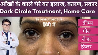 Dark Circles Treatment In Hindi  काले घेरे का इलाज  काले घेरे का इलाज कैसे होता है । [upl. by Jevon]