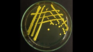 Micrococcus luteus  the most common cleanroom bacterium [upl. by Aibos142]