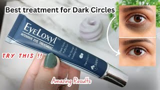 Eyeloxyl Eye Treatment  Best treatment for Dark circles [upl. by Melak]