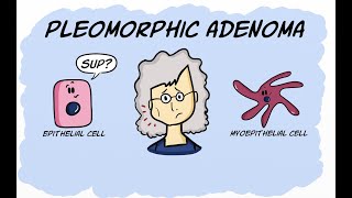 Pleomorphic Adenoma [upl. by Snell]