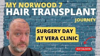 Matts Norwood 6 7 Hair Transplant Journey Vera Clinic Ep 2 Surgery Experience [upl. by Hamal322]