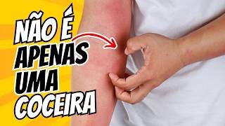 👀 Atenção DIABETES 12 SINAIS De Diabetes na Pele Que Você PRECISA Conhecer IMEDIATAMENTE [upl. by Lyndell101]