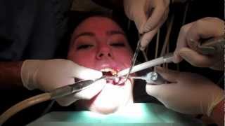 What Is It Like To Get A Filling In Your Tooth With Footage From The Dentists Office [upl. by Assyla]